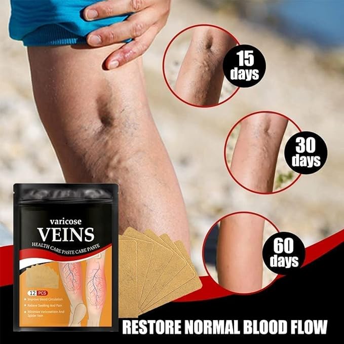 Parche para venas varices