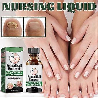 SUERO PARA ELIMINAR HONGO EN UÑAS